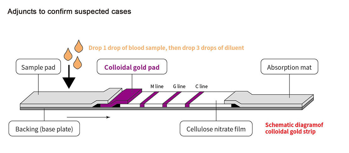 Covid-19 Lgm/lgG Ab Rapid Test