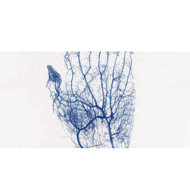 Vein Finder BK-VIA100