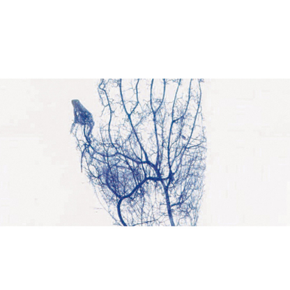 Vein Finder BK-VIA100